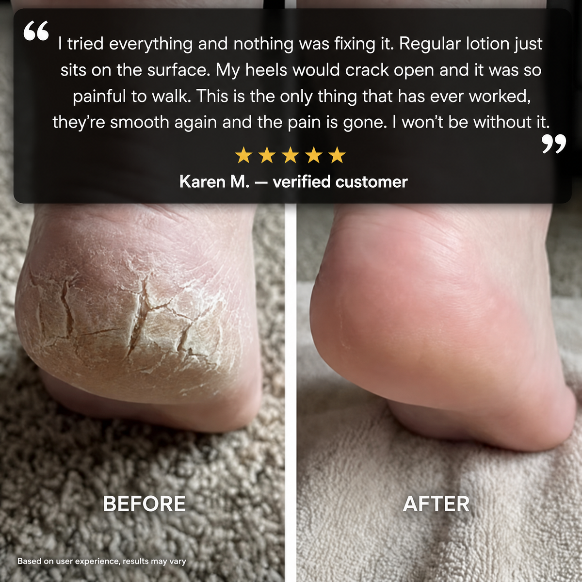 Dtoxed™ 60% Urea Diabetic Foot Repair Stick