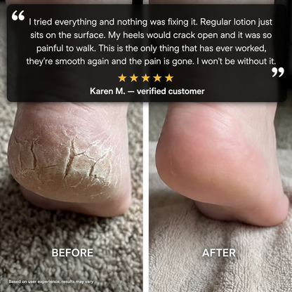 Dtoxed™ 60% Urea Diabetic Foot Repair Stick
